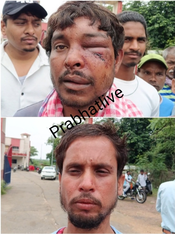 जलापूर्ति पंप हाउस में चोरी का प्रयास विफल, विरोध करने पर पंप ऑपरेटर समेत दो से मारपीट